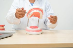 A dental professional uses a dental teeth model to discuss dental issues
