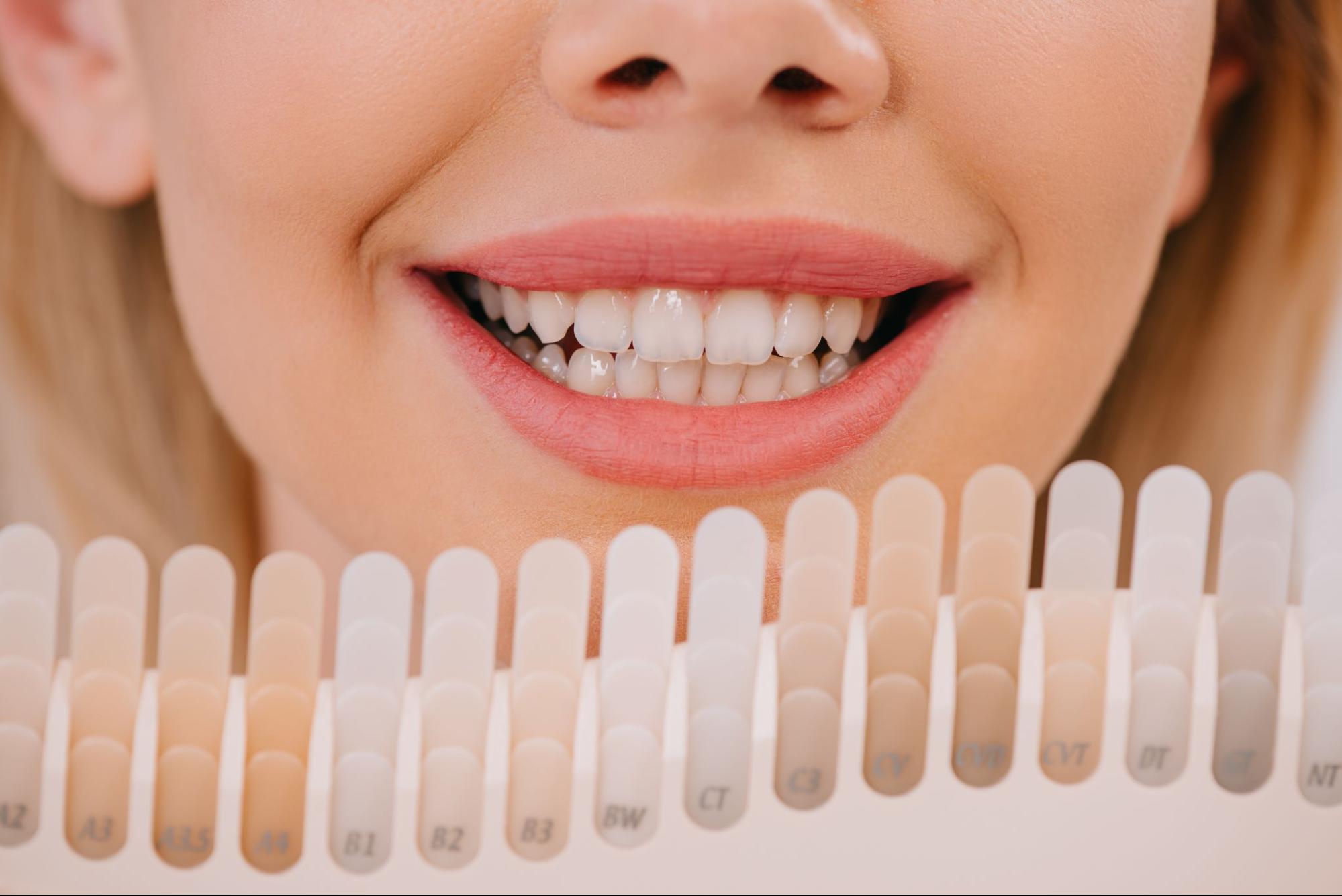 Cropped view of a smiling woman with a tooth shade guide in front of her mouth for veneer color matching.