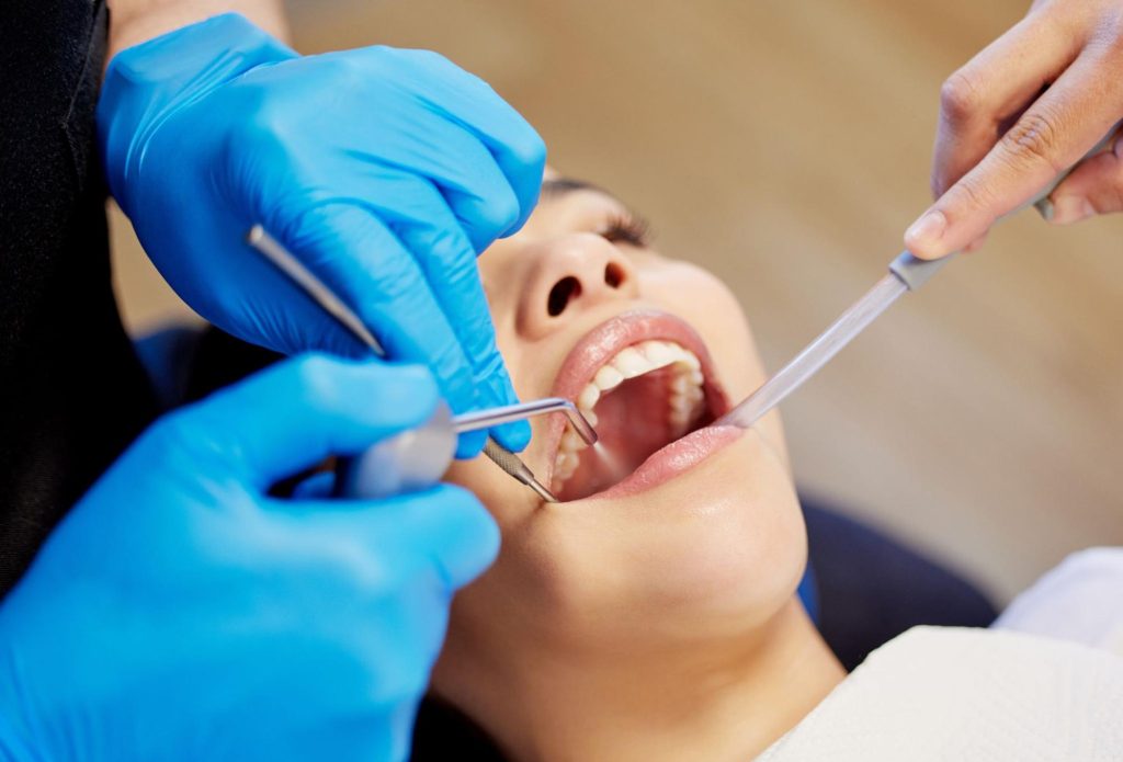 Overhead shot of a woman undergoing a dental cleaning procedure.