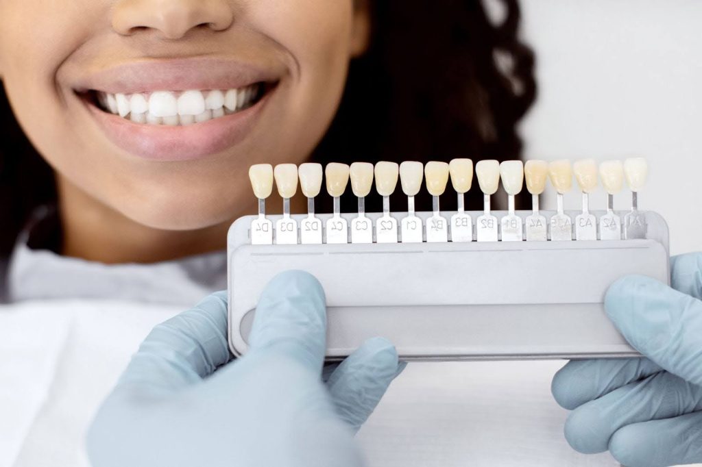 A patient and her dentist examine potential shades of teeth for whitening.